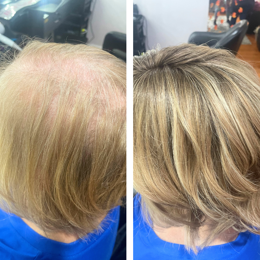 thinning hair solutions boonsboro maryland